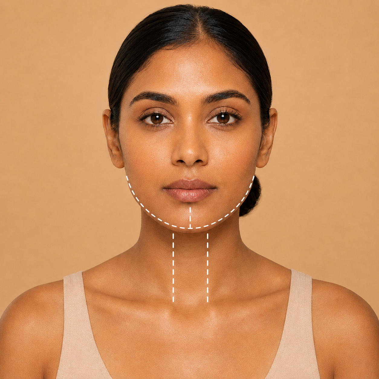 Chin + Anterior Neck