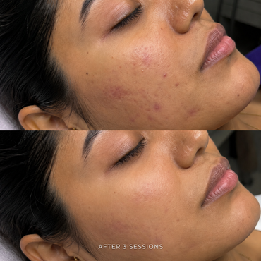 ZENA Algae Peel (Green Peel)
