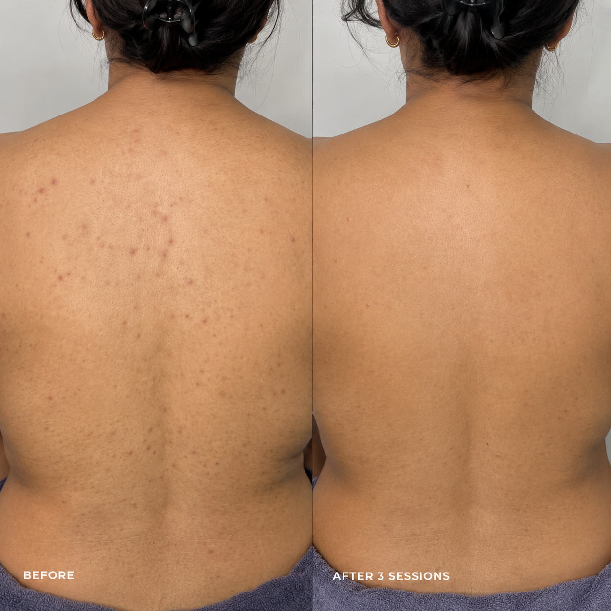 ZENA Algae Peel (Green Peel)