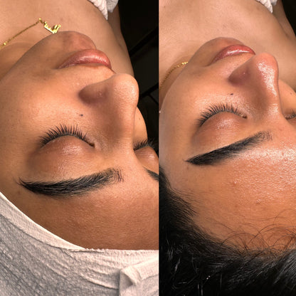 Korean glow Facial