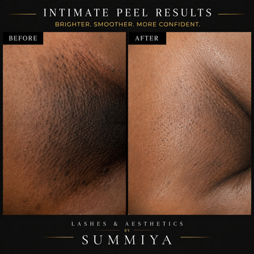 INTIMATE PEEL