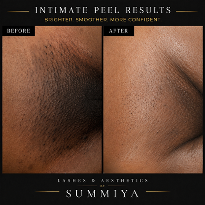 INTIMATE PEEL