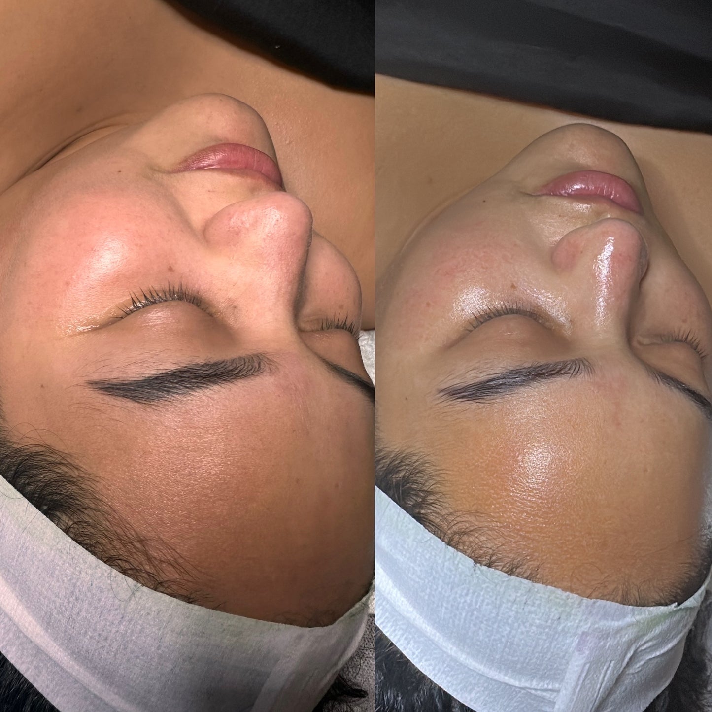 Korean glow Facial