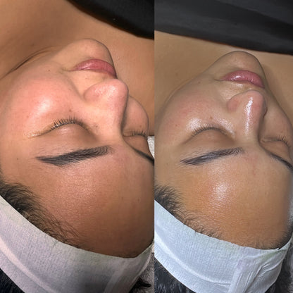 Korean glow Facial