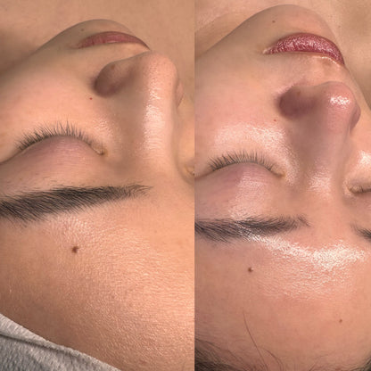Korean glow Facial