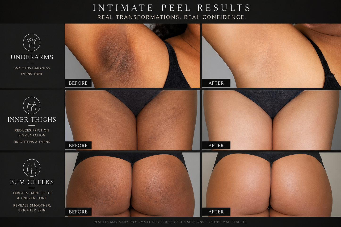 INTIMATE PEEL