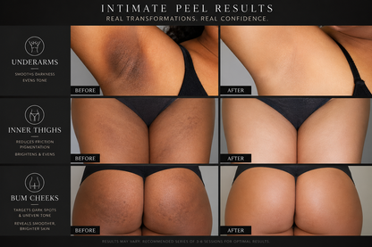 INTIMATE PEEL