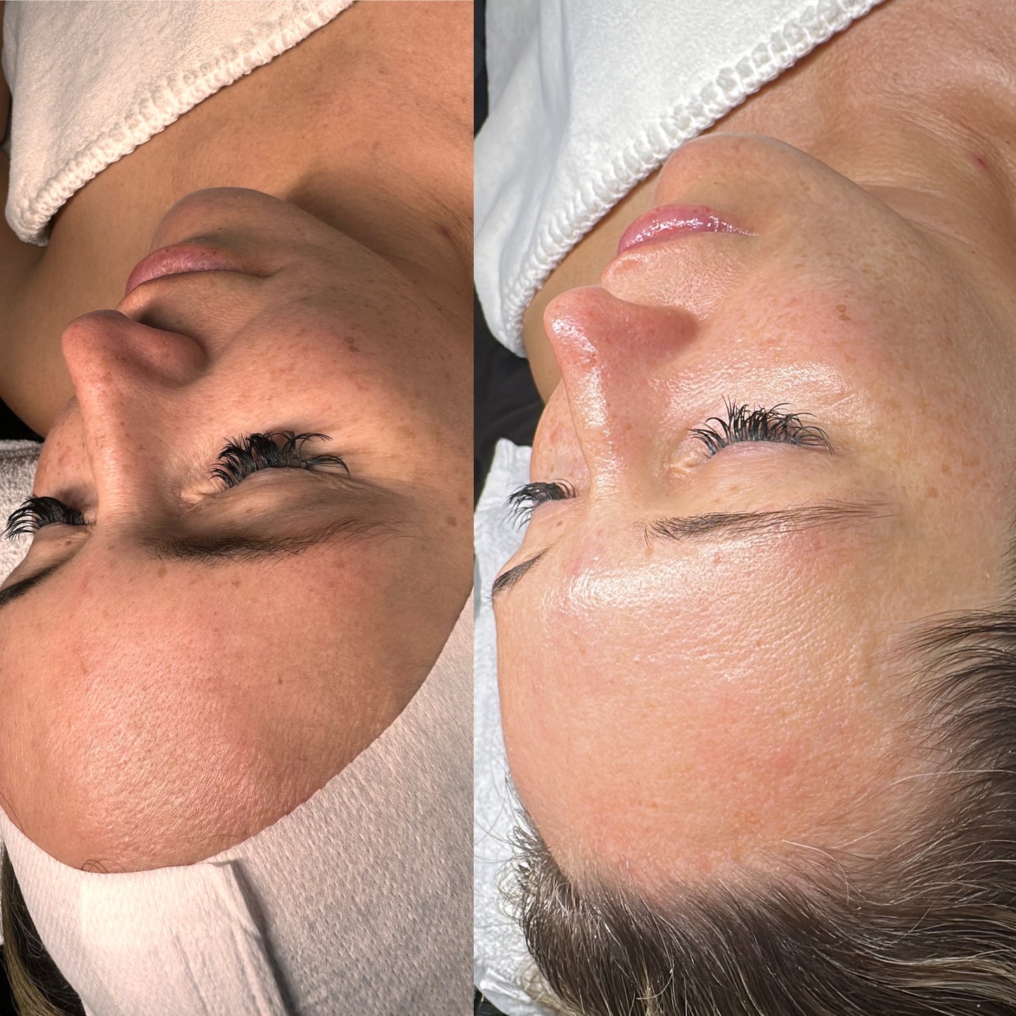 CO₂ carboxy THERAPY
