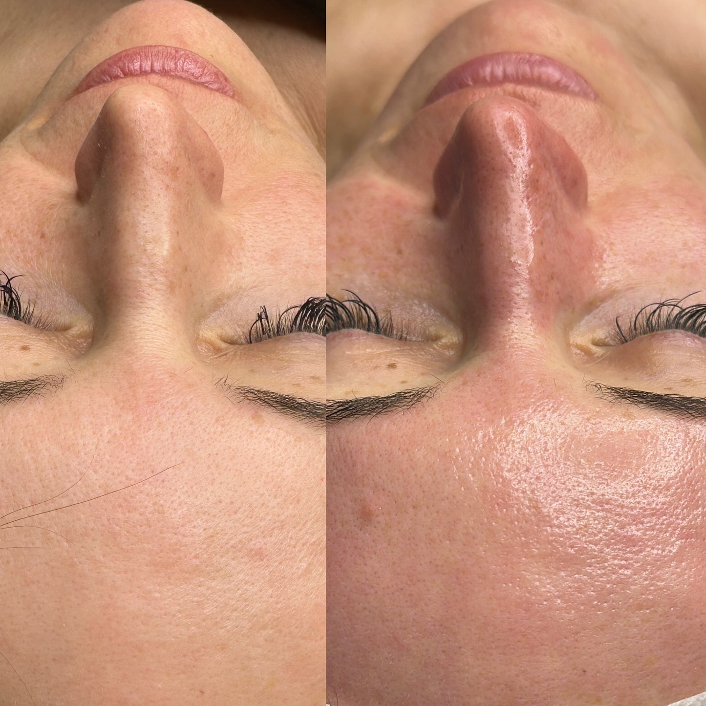 CO₂ carboxy THERAPY