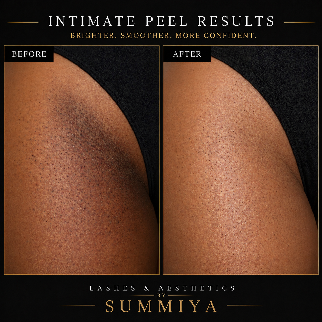 INTIMATE PEEL