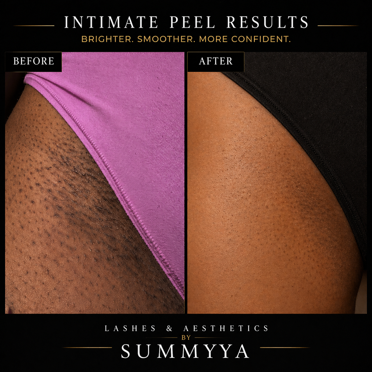 INTIMATE PEEL