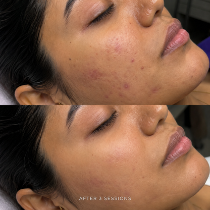 ZENA Algae Peel (Green Peel)